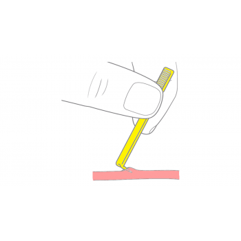 Guide catheter - Vein pick